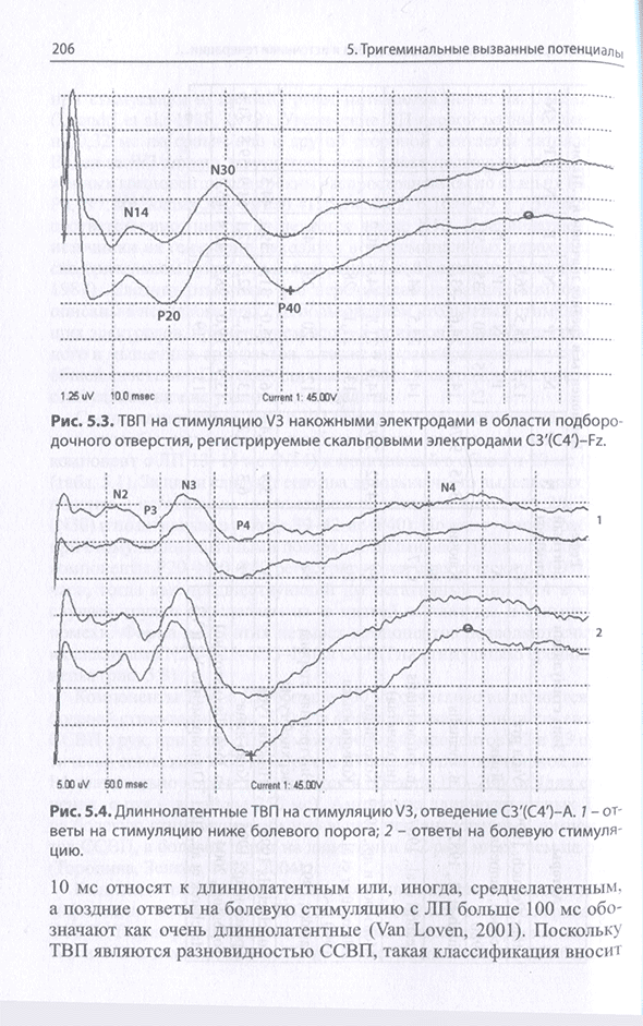 Длиннолатентные ТВП на стимуляцию V3, отведение