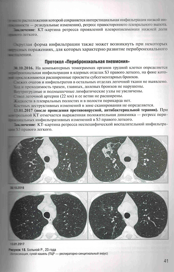 Интоксикация, сухой кашель