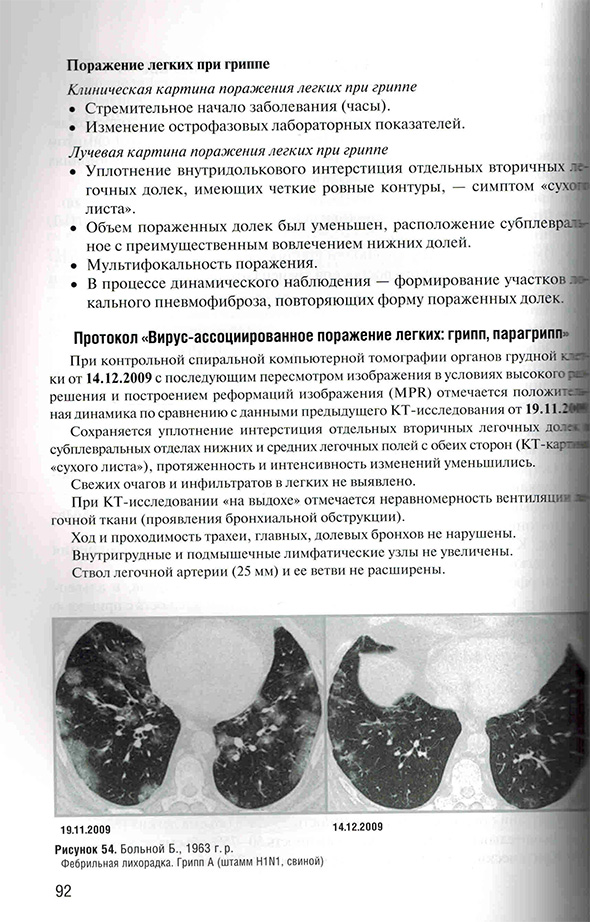 Фебрильная лихорадка.