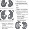 Пример страницы из книги "Высокоразрешающая компьютерная томография легких. Диагностические находки, общие закономерности, заболевания и дифференциальный диагноз" - Эликер Б. М., Вэбб У. Р.