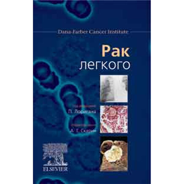 Купить медицинские книги. Книга "Рак легкого". Интернет-магазин shopdon.ru