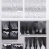 Пример страницы из книги "Ортодонтия и пародонтология: Комбинированные стратегии лечения" - Роберто Кайтсас, Мария Джиачинта Паолоне