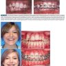 Пример страницы из книги "Современная ортодонтия (новое издание)" - Проффит Уильям Р.
