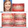 Пример страницы из книги "Современная ортодонтия (новое издание)" - Проффит Уильям Р.
