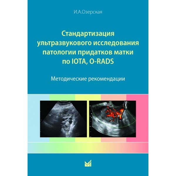 Стандартизация ультразвукового исследования патологии придатков матки по IOTA, O-RADS. Методические рекомендации - Озерская И. А.
