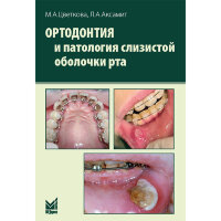Ортодонтия и патология слизистой оболочки рта - Цветкова М. А.