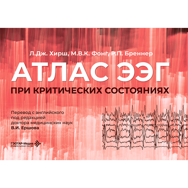 Атлас ЭЭГ при критических состояниях - Хирш Л. Дж., Фонг М. В. К., Бреннер Р. П.