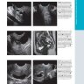 Пример страницы из книги "Ультразвуковая диагностика. Органы брюшной полости и малого таза" - Камая А., Вон-Ю-Чон Дж.