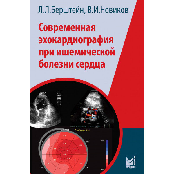 Современная эхокардиография при ишемической болезни сердца - Берштейн Л. Л.