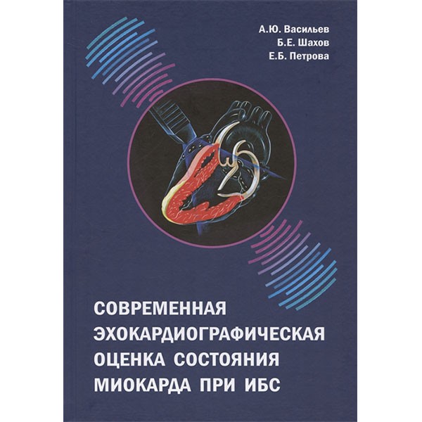 Современная эхокардиографическая оценка состояния миокарда при ИБС - Васильев А. Ю.