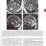 Пример страницы из книги "Врожденные пороки центральной нервной системы: пренатальная диагностика и патоморфология" - М. В. Медведев, И. В. Новикова, О. И. Козлова