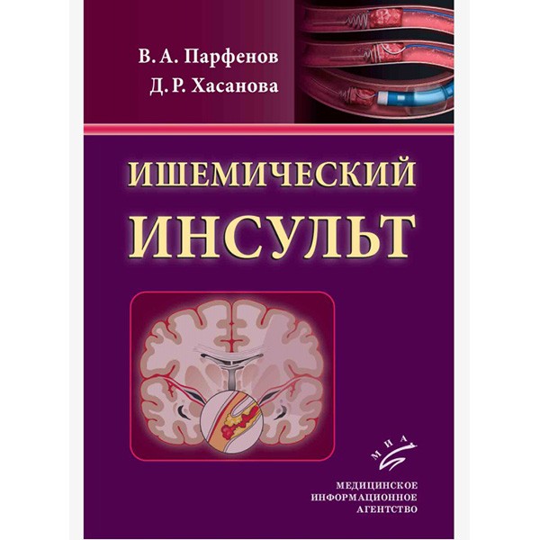 Книга "Ишемический инсульт". Интернет-магазин медицинской книги