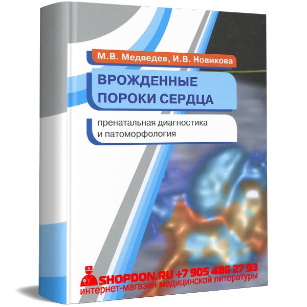 Книга "Врожденные пороки сердца пренатальная диагностика и ...