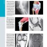 Пример страницы из книги "Лучевая диагностика. Травмы костно-мышечной системы" - Бланкенбейкер Д.