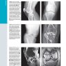 Пример страницы из книги "Лучевая диагностика. Травмы костно-мышечной системы" - Бланкенбейкер Д.
