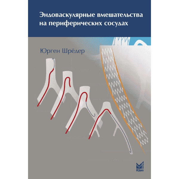 Эндоваскулярные вмешательства на периферических сосудах - Шредер Ю.