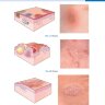 Пример страницы из книги "Цветной атлас клинической дерматологии по Фицпатрику" - К. Вольф, Р. А. Джонсон, Артуро П. Сааведра, Эллен К.