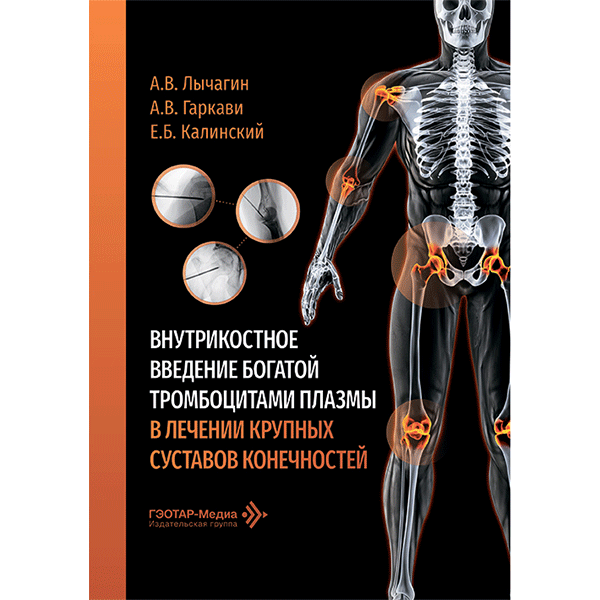 Внутрикостное введение богатой тромбоцитами плазмы в лечении крупных суставов конечностей - Лычагин А. В., Гаркави А. В., Калинский Е. Б.