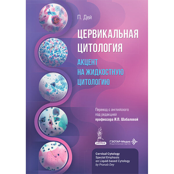 Цервикальная цитология. Акцент на жидкостную цитологию - Дей П.