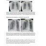 Пример страницы из книги "Основы рентгенографии органов грудной клетки" - К. Кларк, Э. Дюкс