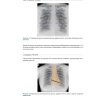 Пример страницы из книги "Основы рентгенографии органов грудной клетки" - К. Кларк, Э. Дюкс