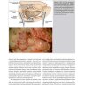 Пример страницы из книги "Общая оториноларингология - хирургия головы и шеи" - Склафани Э.П., Дилески Р. А., Питман М. Дж.