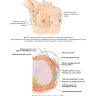 Пример страницы из книги "Основы и принципы онкопластической хирургии при раке молочной железы" - Матрай З., Гуляш Г., Ковач Т. И.