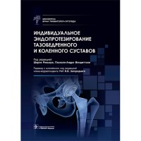 Индивидуальное эндопротезирование тазобедренного и коленного суставов - Ривьер Ш., Вендиттоли П.
