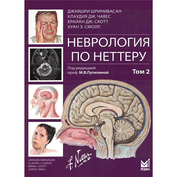 Неврология по Неттеру. Том 2 - Джаяшри Шринивасан, Клаудия ДЖ. Чавес, Брайан ДЖ. Скотт, Хуан Э. Смолл