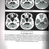 Пример страницы из книги "Лучевая диагностика заболеваний основания черепа и мостомозжечкового угла" - Труфанов Г. Е.