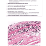 Пример страницы из книги "Ревматические болезни. Гистологический атлас" - С. Г. Раденска-Лоповок