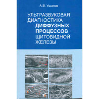 Ультразвуковая диагностика диффузных процессов щитовидной железы - Ушаков А. В.