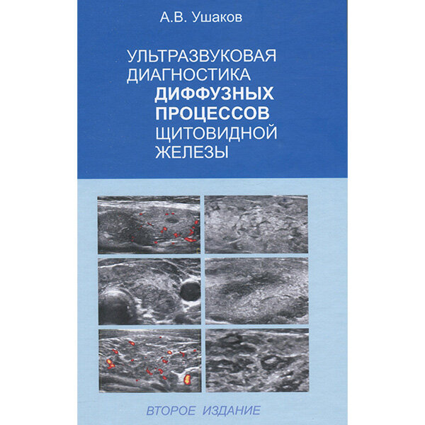 Ультразвуковая диагностика диффузных процессов щитовидной железы - Ушаков А. В.