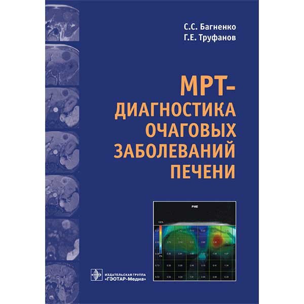 Книга "MPT-диагностика очаговых заболеваний печени". Купить мед книги ...