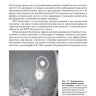 Пример страницы из книги "Лучевая диагностика. Оториноларингология" - Эрвин А. Дюннебир