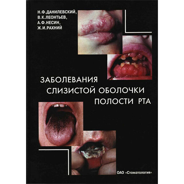 Заболевания слизистой оболочки полости рта - Данилевский Н. Ф., Леонтьев В. К., Рахний Ж. И.