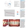 Пример страницы из книги "Ортодонтическое лечение. Атлас. Практическое руководство" - Андреа Вихельхаус