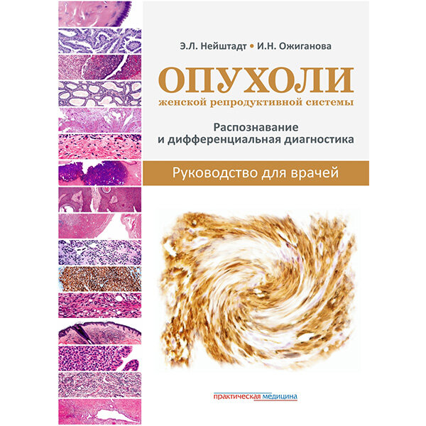 Опухоли женской репродуктивной системы. Распознавание и дифференциальная диагностика. Руководство для врачей - Нейштадт Э. Л., Ожиганова И. Н.