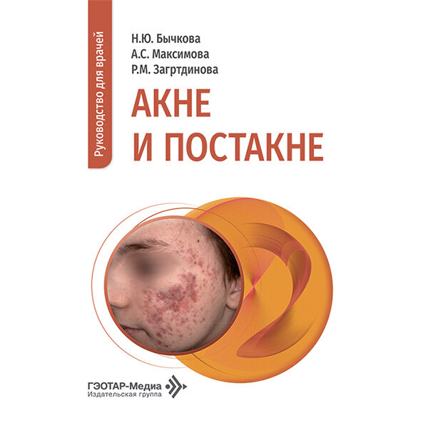 Акне и постакне. Руководство для врачей - Бычкова Н. Ю., Максимова А. С., Загртдинова Р. М.