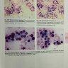Пример страницы из книги "Лабораторная диагностика заболеваний щитовидной железы" - В. В. Долгов, И. П. Шабалова, А. В. Селиванова