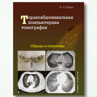 Торакоабдоминальная компьютерная томография. Образы и симптомы - А. Л. Юдин