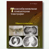 Торакоабдоминальная компьютерная томография. Образы и симптомы - А. Л. Юдин