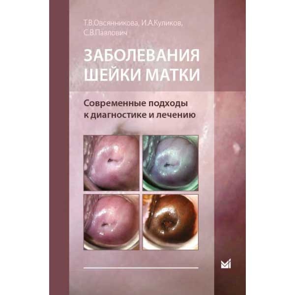 Заболевания шейки матки. Современные подходы к диагностике и лечению - Овсянникова Т. В.