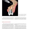 Пример страницы из книги "Руководство по микрохирургической эндодонтии" - Арнальдо Кастеллуччи