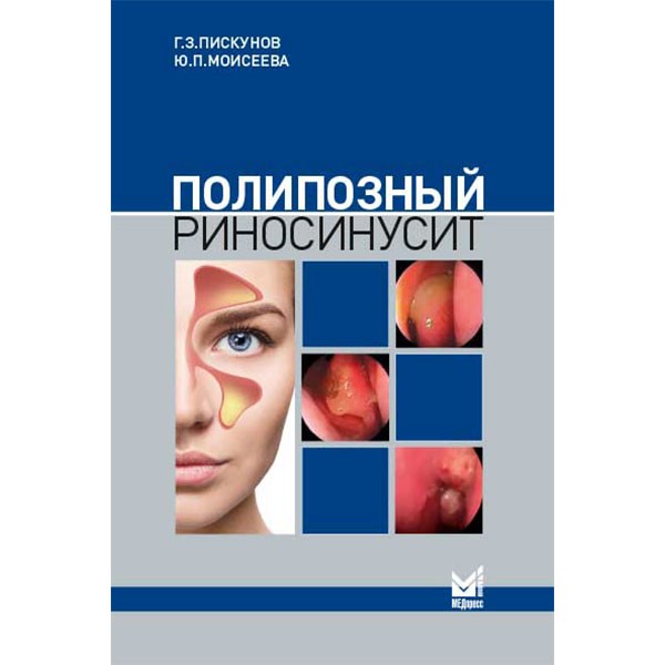 Полипозный риносинусит - Пискунов Г. З.