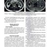 Пример страницы из книги "Визуализация заболеваний почек, мочеточников и мочевого пузыря" - Труфанов Г. Е.