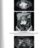 Пример страницы из книги "Визуализация заболеваний почек, мочеточников и мочевого пузыря" - Труфанов Г. Е.