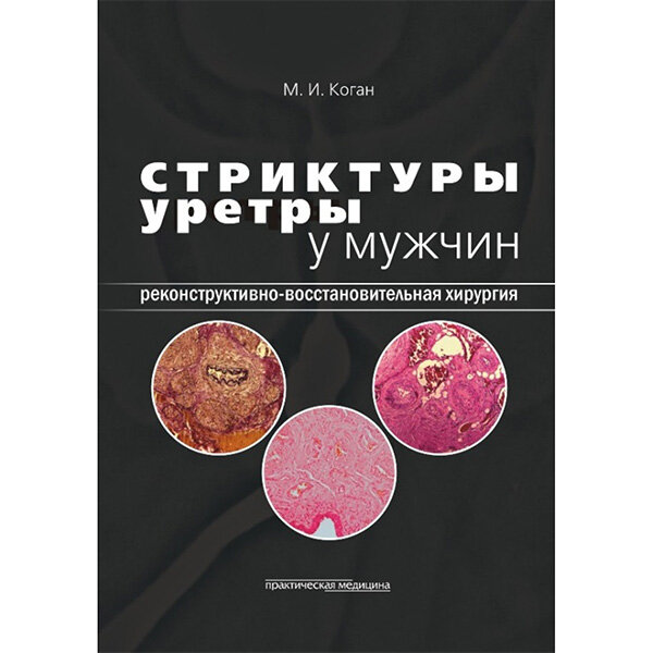 Стриктуры уретры у мужчин. Реконструктивно-восстановительная хирургия - Коган М. И.