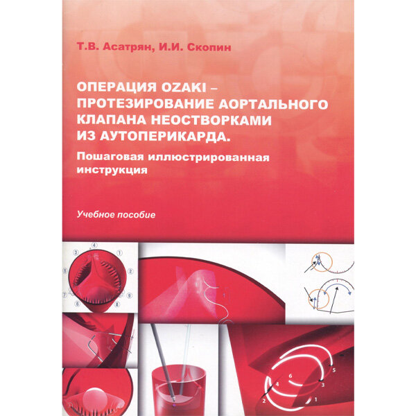 Операция Ozaki – протезирование аортального клапана неостворками из аутоперикарда. Пошаговая иллюстрированная инструкция: Учебное пособие - Асатрян Т. В., Скопин И. И.