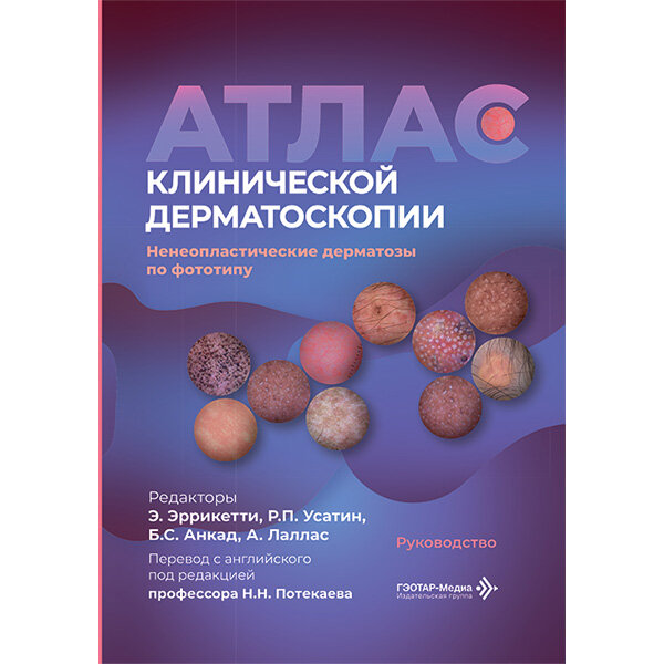 Атлас клинической дерматоскопии. Ненеопластические дерматозы по фототипу. Руководство - Э. Эррикетти, Р. П. Усатина, Б. С. Анкада, А. Лалласа
